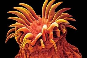 Trematodų parazitai žmonėms