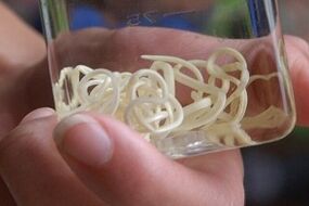 parazitai iš žmogaus kūno