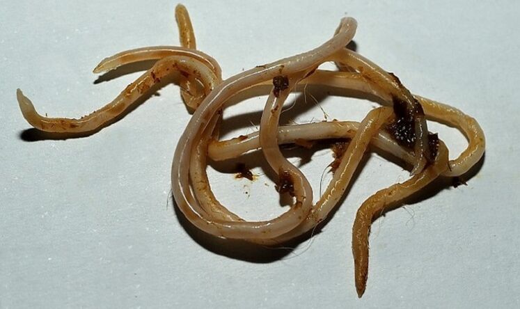 toksokarų iš žmogaus kūno